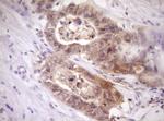 PELI1 Antibody in Immunohistochemistry (Paraffin) (IHC (P))