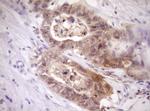 PELI1 Antibody in Immunohistochemistry (Paraffin) (IHC (P))