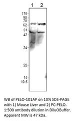 PELO Polyclonal Antibody