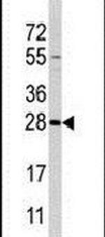 PEMT Antibody in Western Blot (WB)