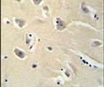 PENK Antibody in Immunohistochemistry (IHC)