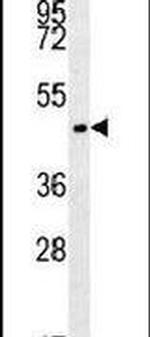 PENK Antibody in Western Blot (WB)