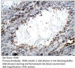 PERK Polyclonal Antibody