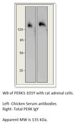 PERK Polyclonal Antibody