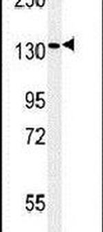 PEX1 Antibody in Western Blot (WB)
