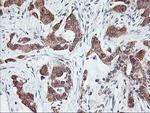 PFDN6 Antibody in Immunohistochemistry (Paraffin) (IHC (P))