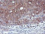 PFDN6 Antibody in Immunohistochemistry (Paraffin) (IHC (P))