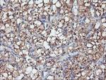 PFDN6 Antibody in Immunohistochemistry (Paraffin) (IHC (P))