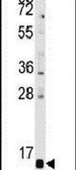 PFDN6 Antibody in Western Blot (WB)