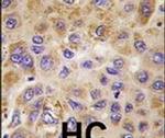 PFKFB1 Antibody in Immunohistochemistry (IHC)