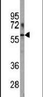 PFKFB1 Antibody in Western Blot (WB)