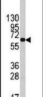 PFKFB1 Antibody in Western Blot (WB)