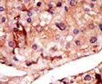 PFKFB2 Antibody in Immunohistochemistry (IHC)