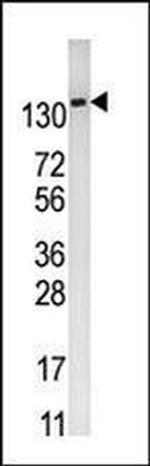PFKFB2 Antibody in Western Blot (WB)