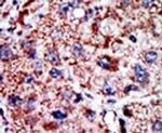PFKL Antibody in Immunohistochemistry (IHC)