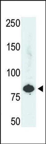 PFKL Antibody in Western Blot (WB)