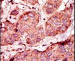 PFKP Antibody in Immunohistochemistry (IHC)