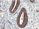 PFKP Antibody in Immunohistochemistry (Paraffin) (IHC (P))