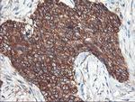 PFKP Antibody in Immunohistochemistry (Paraffin) (IHC (P))