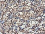 PFKP Antibody in Immunohistochemistry (Paraffin) (IHC (P))