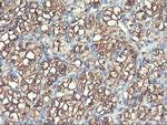 PFKP Antibody in Immunohistochemistry (Paraffin) (IHC (P))