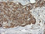 PFKP Antibody in Immunohistochemistry (Paraffin) (IHC (P))