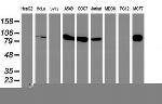 PFKP Antibody in Western Blot (WB)