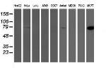 PFKP Antibody in Western Blot (WB)