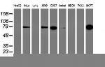 PFKP Antibody in Western Blot (WB)