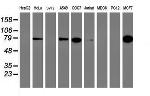 PFKP Antibody in Western Blot (WB)