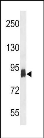 PFKP Antibody in Western Blot (WB)