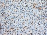 PFN1 Antibody in Immunohistochemistry (Paraffin) (IHC (P))