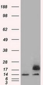 PFN1 Antibody in Western Blot (WB)