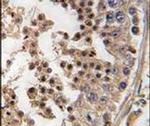 PFTK1 Antibody in Immunohistochemistry (IHC)