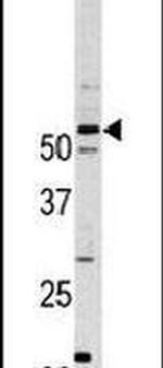 PFTK1 Antibody in Western Blot (WB)