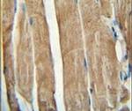 PGAM2 Antibody in Immunohistochemistry (IHC)