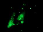PGAM2 Antibody in Immunocytochemistry (ICC/IF)