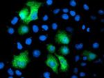 PGAM2 Antibody in Immunocytochemistry (ICC/IF)