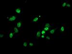 PGAM2 Antibody in Immunocytochemistry (ICC/IF)