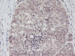 PGAM2 Antibody in Immunohistochemistry (Paraffin) (IHC (P))