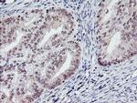PGAM2 Antibody in Immunohistochemistry (Paraffin) (IHC (P))