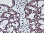 PGAM2 Antibody in Immunohistochemistry (Paraffin) (IHC (P))