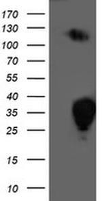 PGAM2 Antibody in Western Blot (WB)