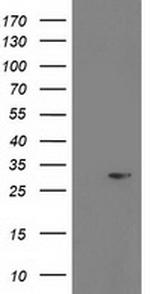PGAM2 Antibody in Western Blot (WB)