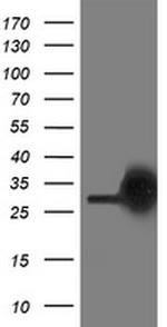 PGAM2 Antibody in Western Blot (WB)