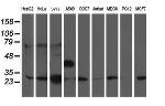 PGAM2 Antibody in Western Blot (WB)