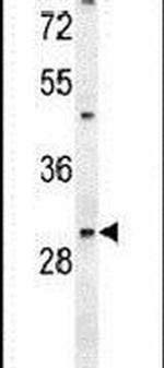 PGAM2 Antibody in Western Blot (WB)