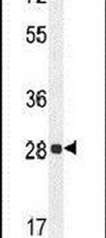 PGAM2 Antibody in Western Blot (WB)