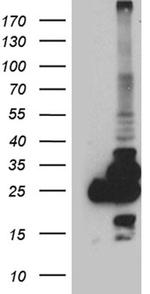 PGAM4 Antibody in Western Blot (WB)