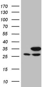 PGAM4 Antibody in Western Blot (WB)